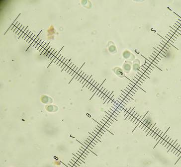 Amphinema byssoides? (Amphinema byssoides)